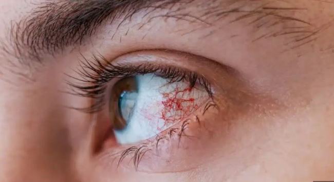 المستشفى المحلي بالفحص: انتفاع أكثر من 100 شخص بخدمات يوم مفتوح لتقصي اعتلال الشبكية السكري